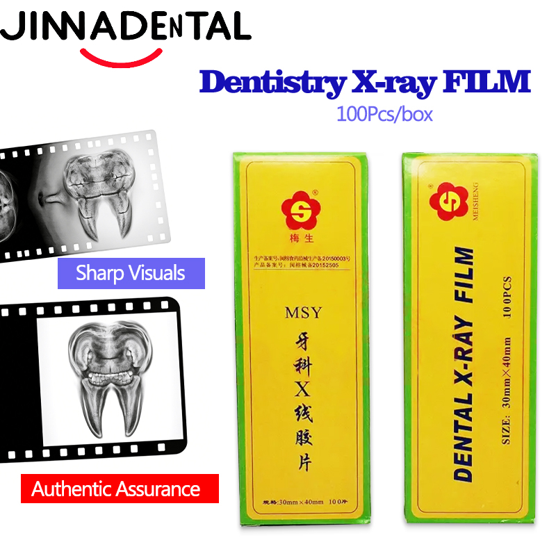 Medical Lab Images - Film Rontgen Gigi 30*40mm, Film Gambar