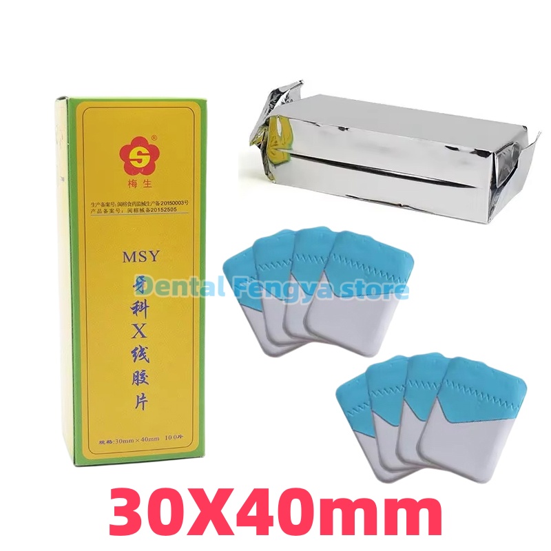 Medical Lab Images - 100Pcs/Box Film Rontgen Digital Gigi MSY